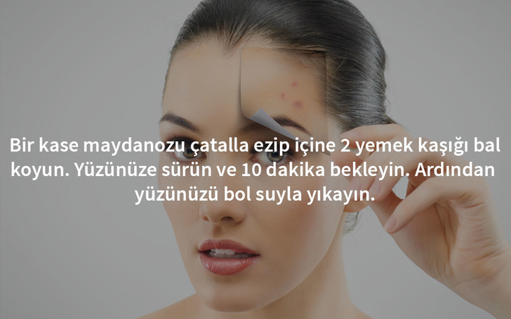 sivilce-maydanoz