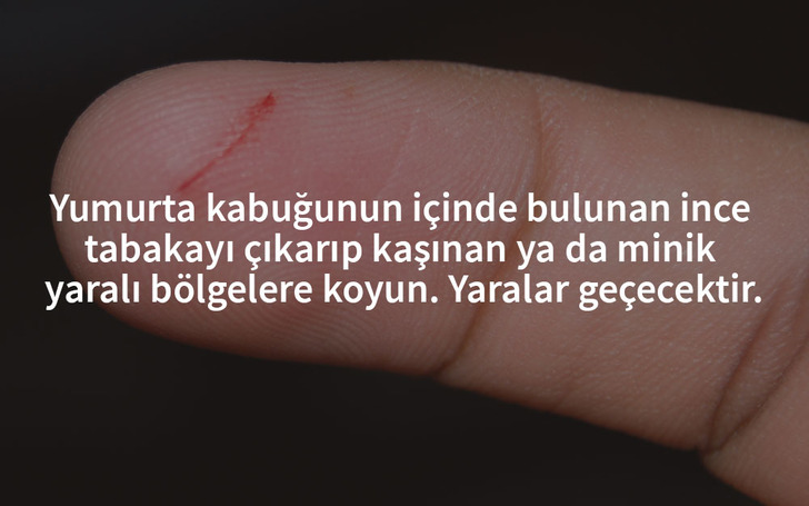 yumurta-kabugu-ilk-yardim