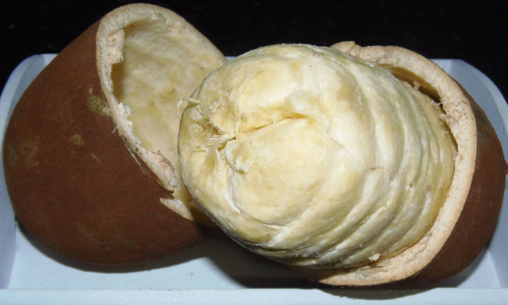 celiachia
