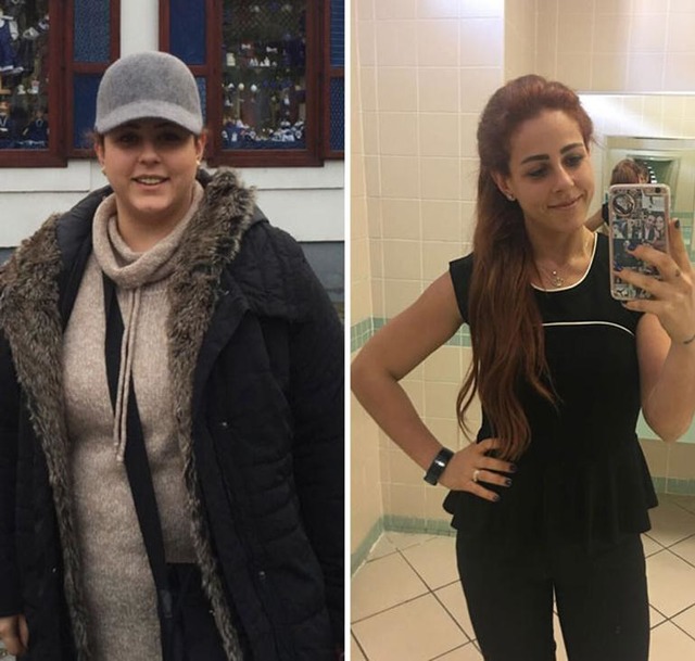 Ameliyat Olmadan ve İlaç Kullanmadan 40 Kilo Vermeyi Başaran Ece Atmaca