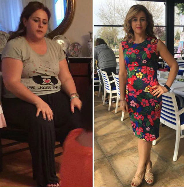 Ameliyat Olmadan ve İlaç Kullanmadan 40 Kilo Vermeyi Başaran Ece Atmaca