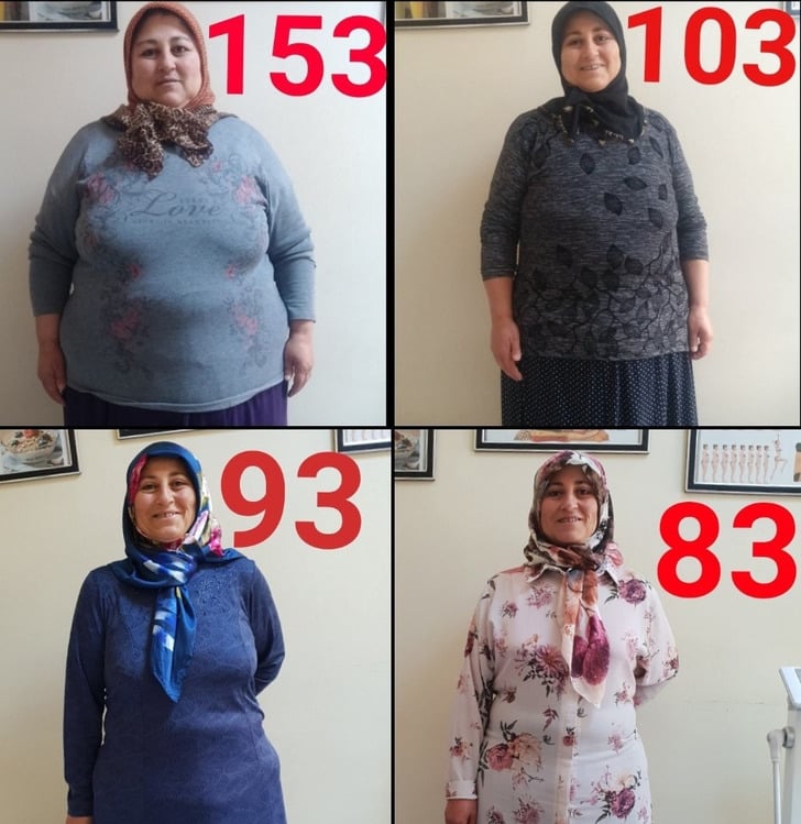 https://www.yenisafak.com/hayat/obeziteyi-engelli-oglu-icin-yendi-70-kilo-verdi-3409934 | Yenişafak