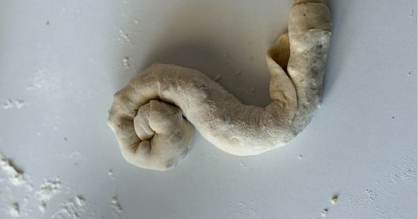 cevizli-kete-asama5