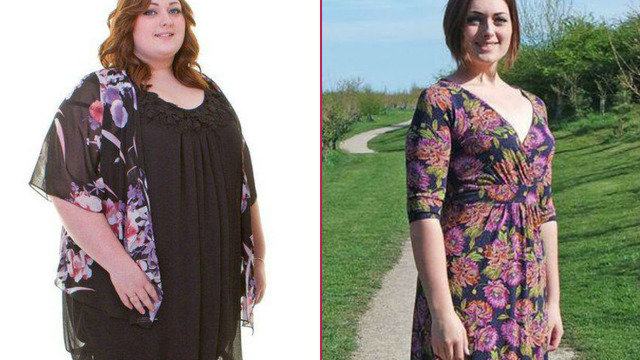 Yolda Yürürken Yüzüne Kebap Atılınca Tam 63 Kilo Veren Genç Kadın