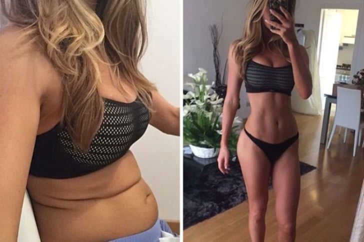 Instagram'da Gördüğünüz Her Kusursuz Vücuda İnanmamanız Gerektiğinin 12 Kanıtı