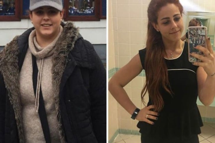 Ameliyat Olmadan ve İlaç Kullanmadan 40 Kilo Vermeyi Başaran Ece Atmaca