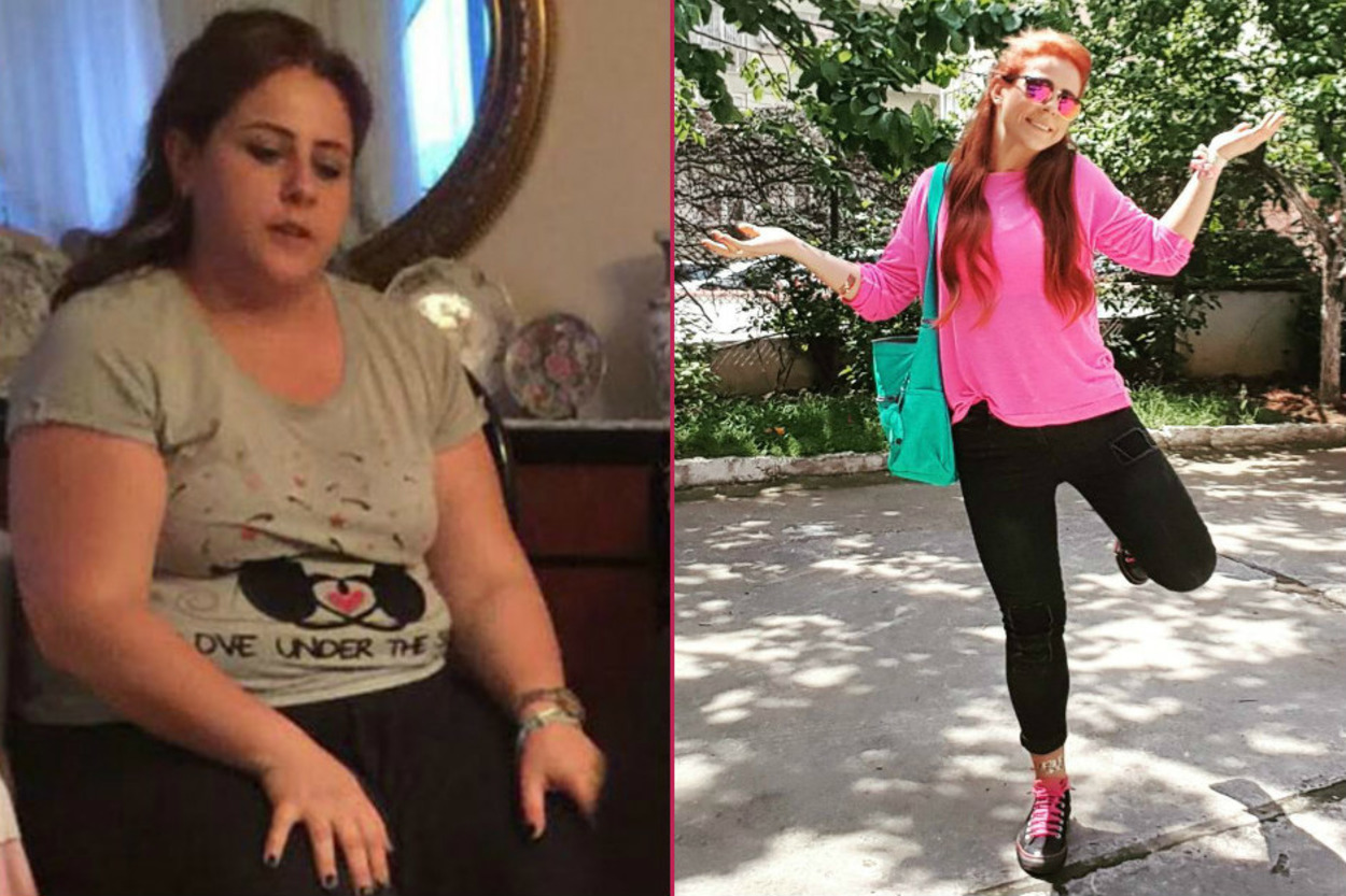 Ameliyat Olmadan ve İlaç Kullanmadan 40 Kilo Vermeyi Başaran Ece Atmaca